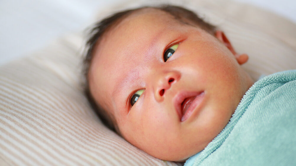 Florida Newborn Jaundice Lawyers