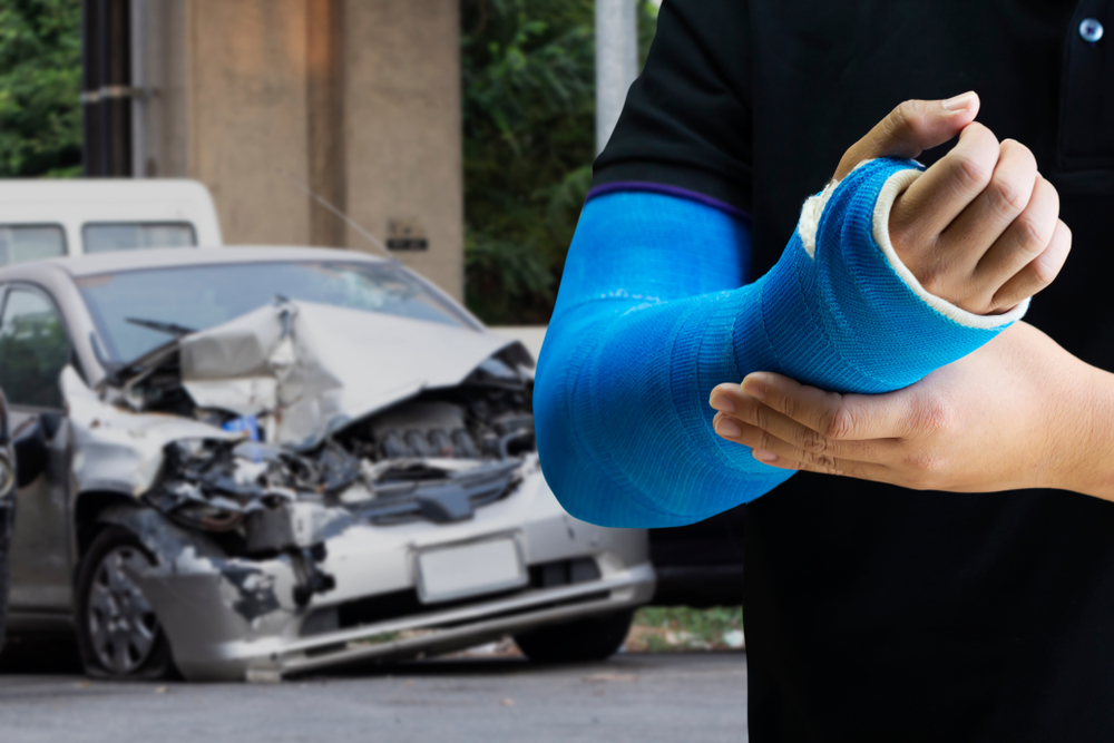 Coral Springs Car Accident Lawyers